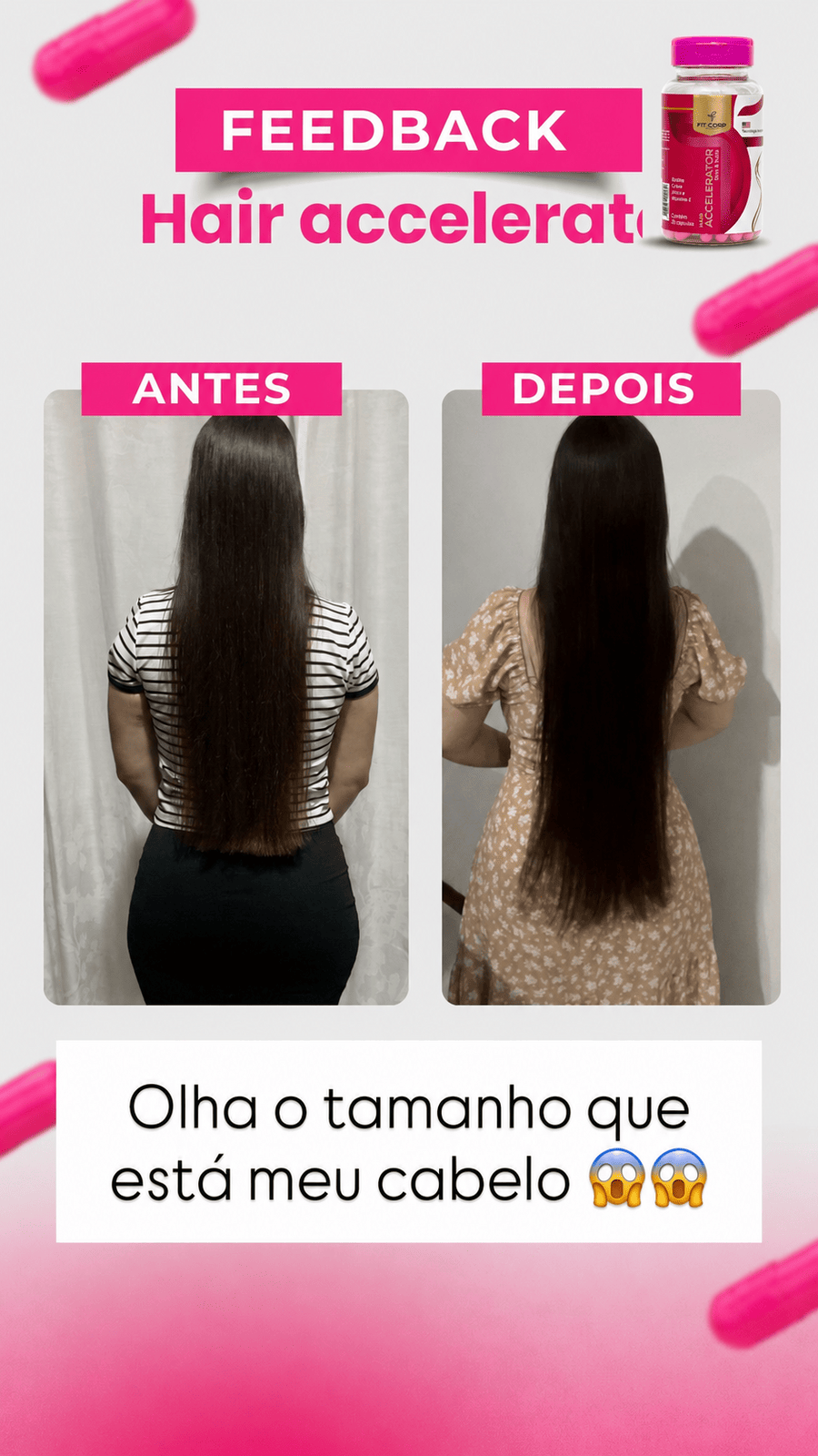 Antes e depois — Hair Accelerator