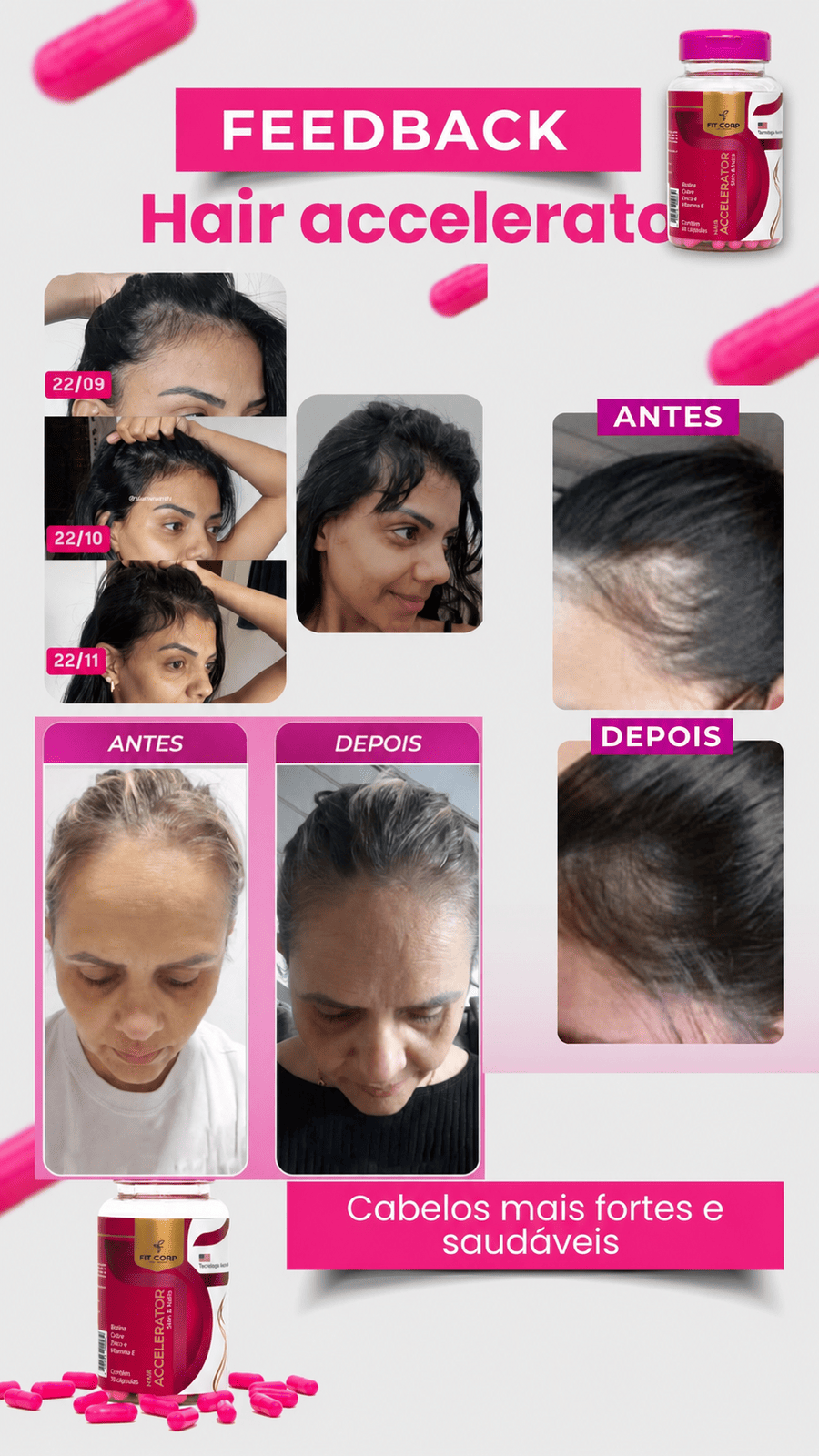 Antes e depois — Hair Accelerator