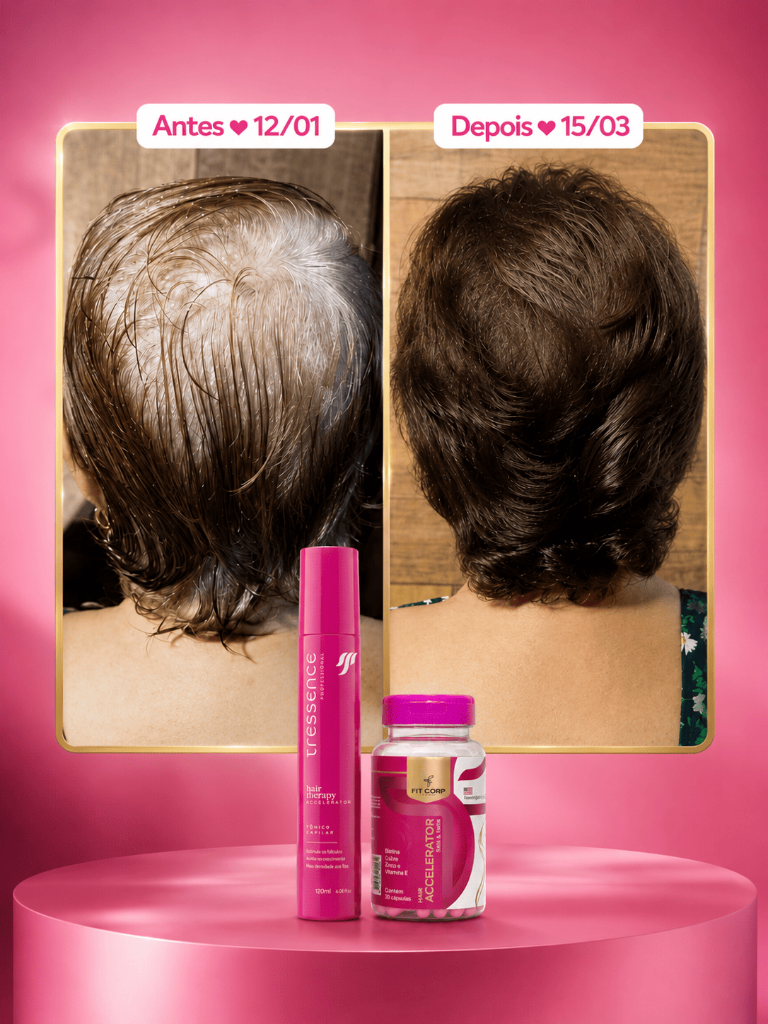 Antes e depois — Hair Accelerator